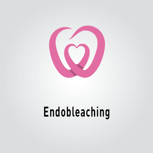 Endobleaching