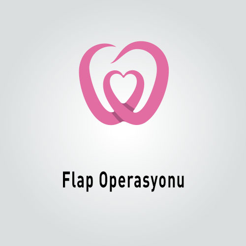 Flap Operasyonu